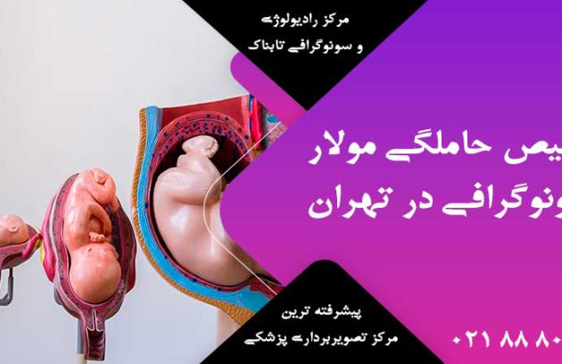 تشخیص حاملگی مولار با سونوگرافی در تهران