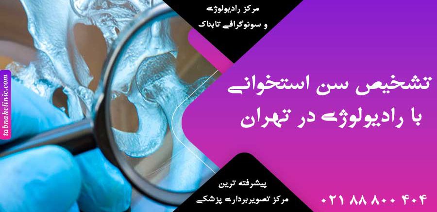 تشخیص سن استخوانی با رادیولوژی در تهران