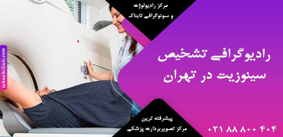 رادیوگرافی تشخیص سینوزیت در تهران
