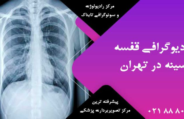 رادیوگرافی قفسه سینه در تهران