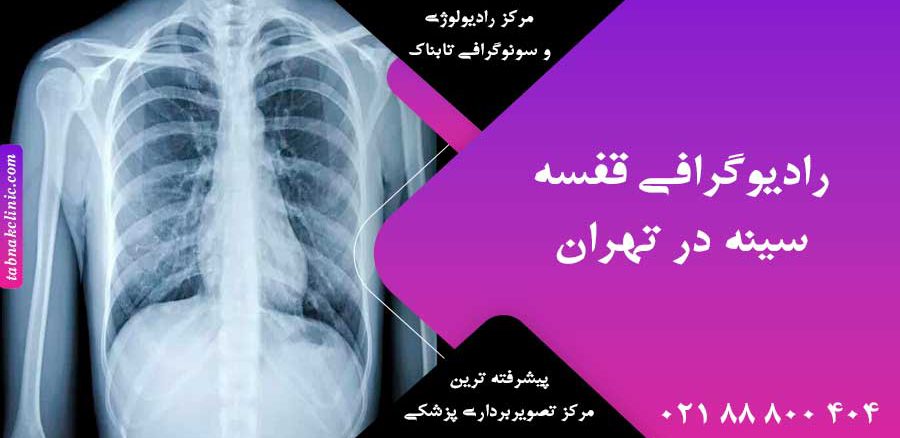 رادیوگرافی قفسه سینه در تهران