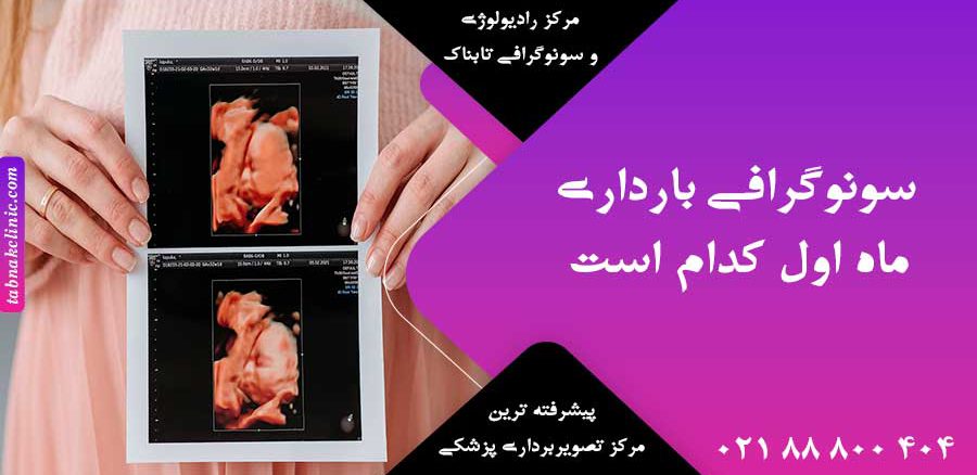 سونوگرافی بارداری ماه اول کدام است