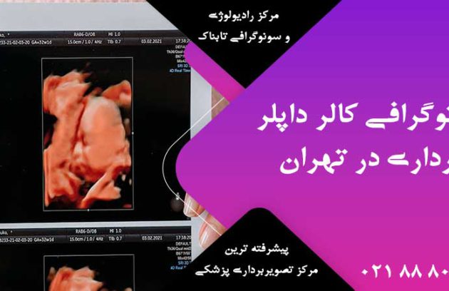 سونوگرافی کالر داپلر بارداری در تهران