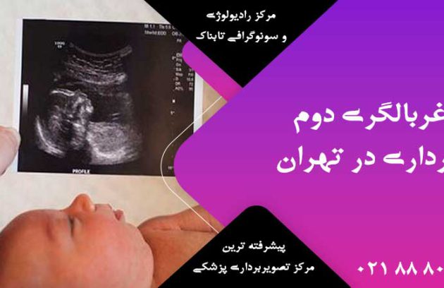 غربالگری دوم بارداری در تهران