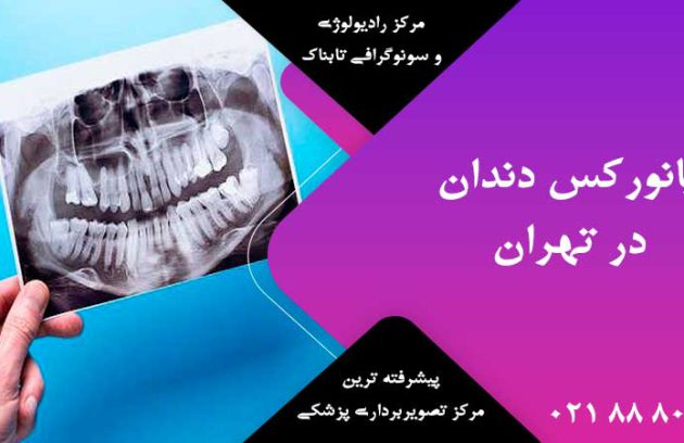 پانورکس دندان در تهران