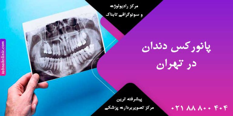 پانورکس دندان در تهران